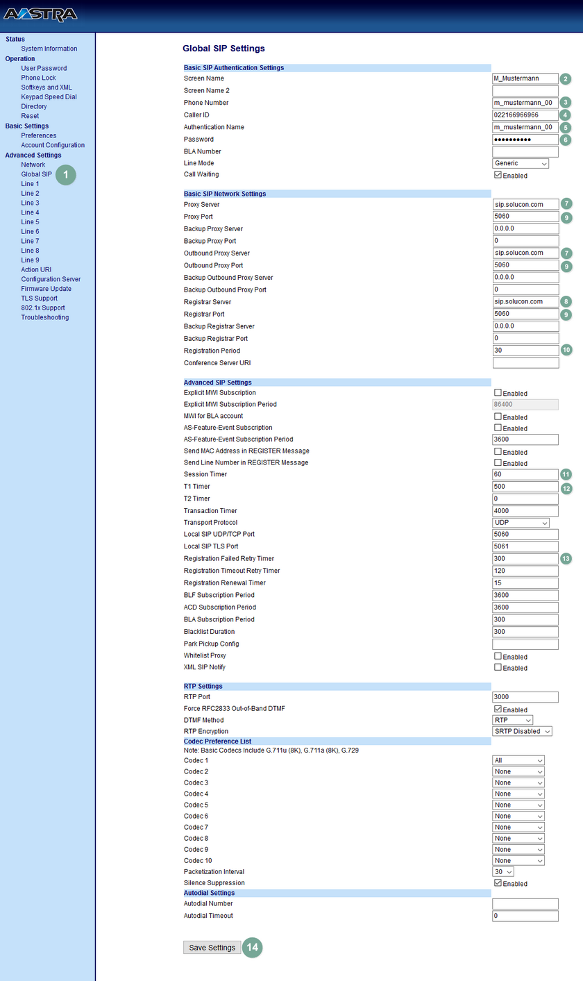 Ansicht Aastra Konfigurationsprozess Global SIP Settings