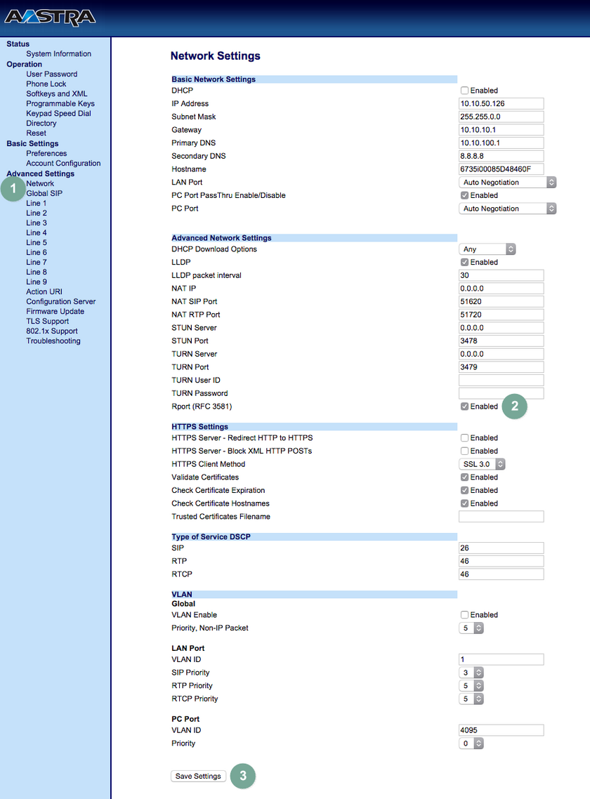 Aastra Konfigurationsprozess Network Settings